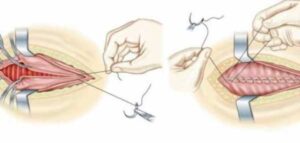 Best cosmetic gynecology Surgeon in pakistan