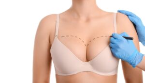Non Surgical Breast Lifting