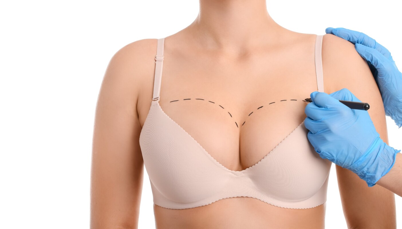 Non Surgical Breast Lifting