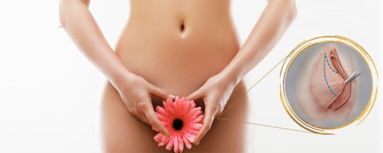 Hymenoplasty in Pakistan