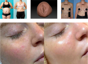 Best laser clinic in Pakistan