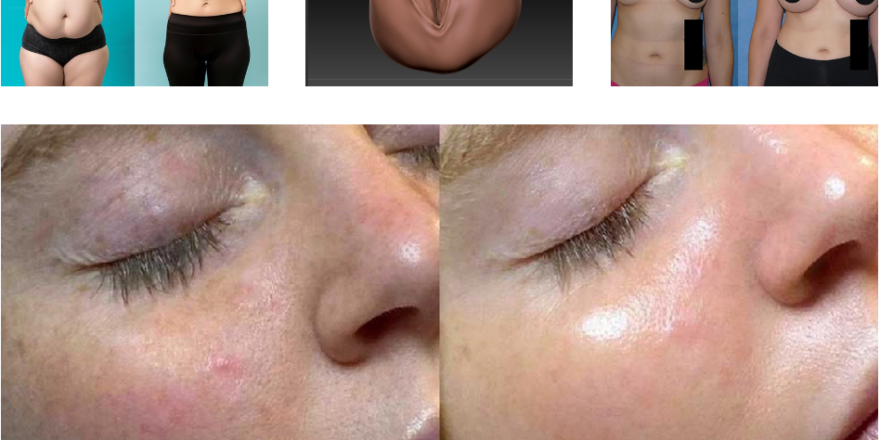 Best laser clinic in Pakistan