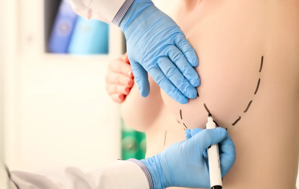 breast lifting in Pakistan