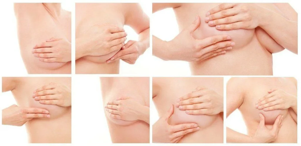 Breast Lifting in Pakistan