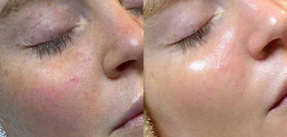 Best laser clinic in Pakistan