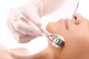Microneedling Services in Pakistan