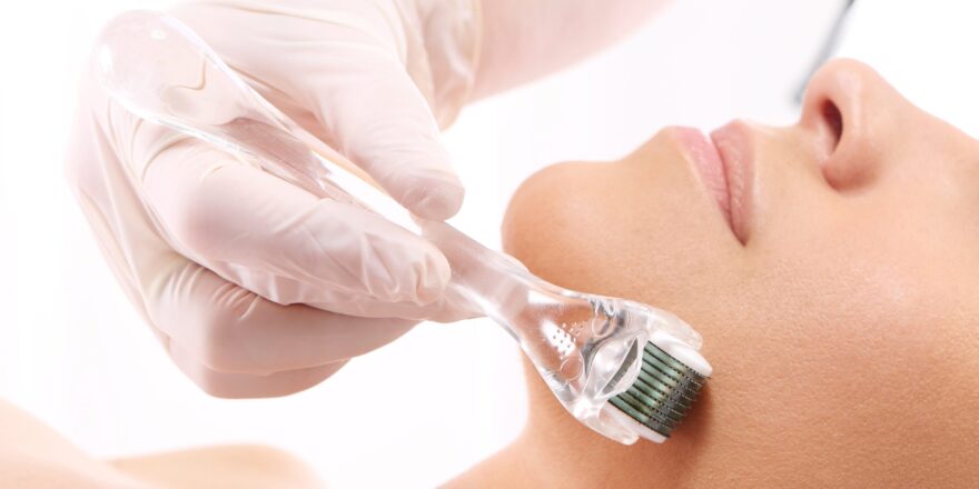 Microneedling Services in Pakistan