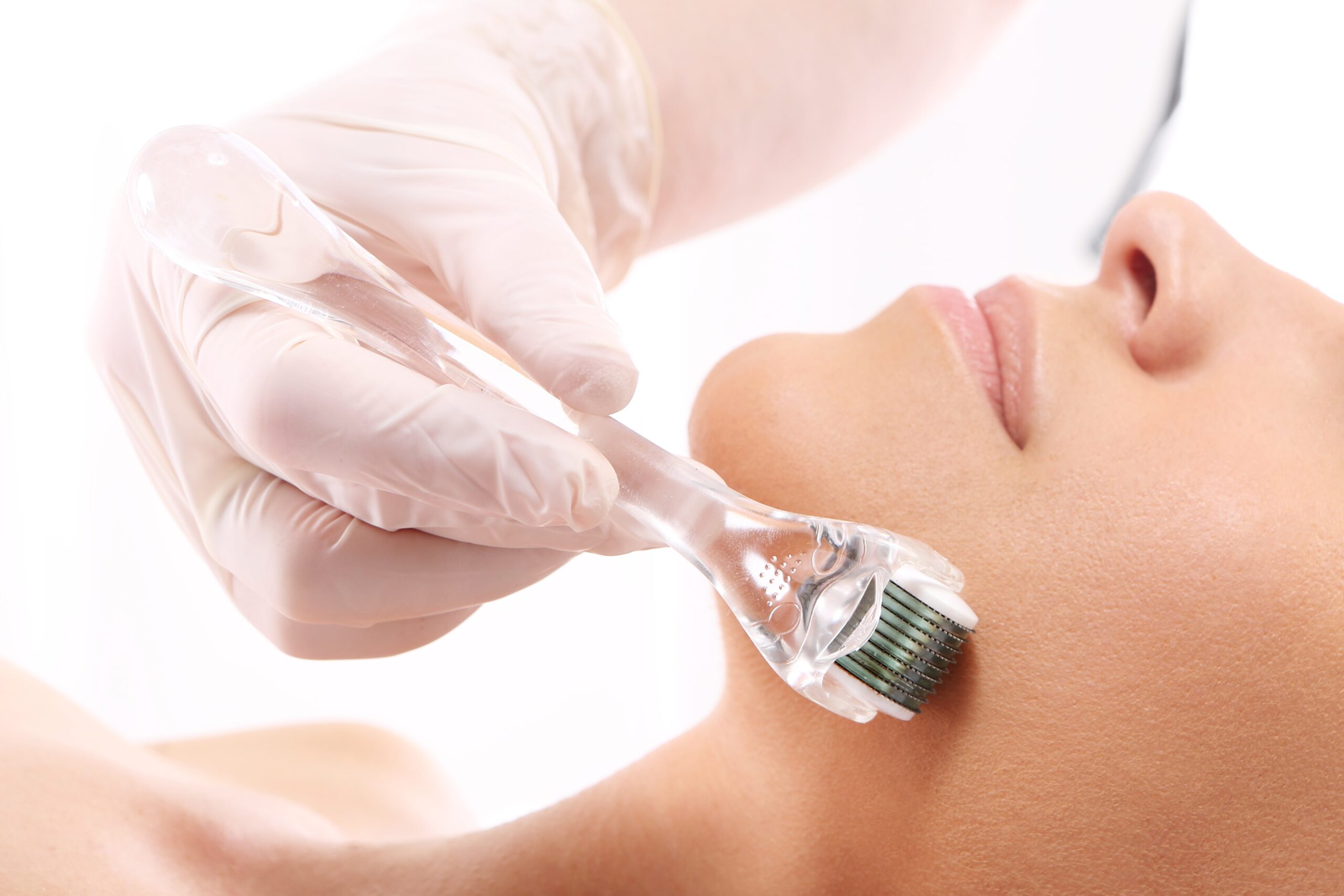 Microneedling Services in Pakistan