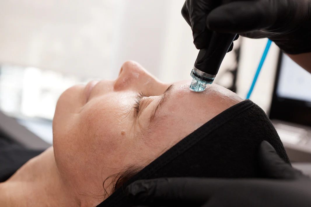 Best Hydrafacial in Lahore | Prepared By Lemonade Aesthetic Clinic