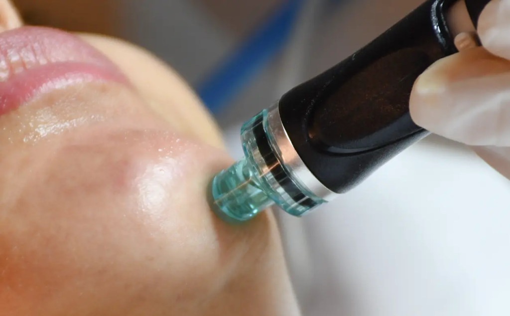 Hydrafacial