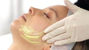 chemical peel cost in pakistan