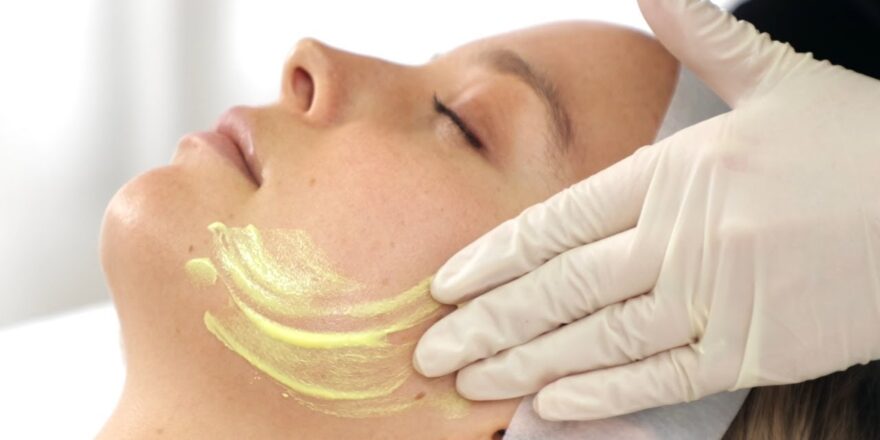 chemical peel cost in pakistan