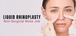 non surgical rhinoplasty Islamabad