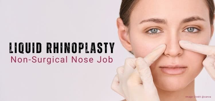 non surgical rhinoplasty Islamabad