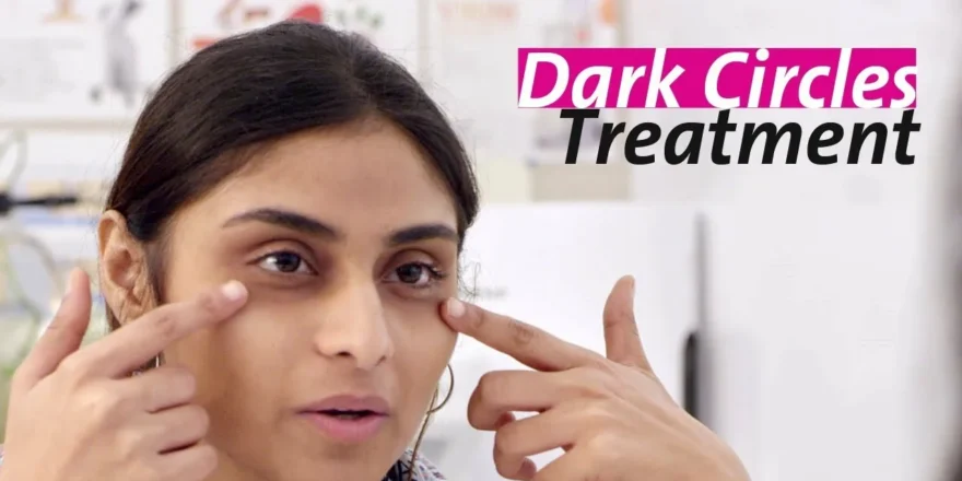Dark Circle Treatment Islamabad | Tear Trough Rejuvenation