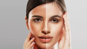 Glutathione Injections Islamabad