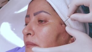 Non Surgical Face Lift Islamabad