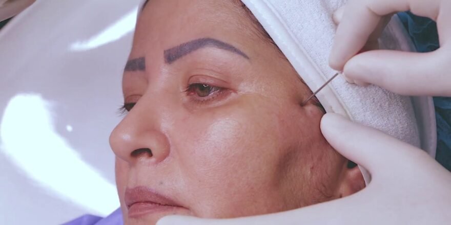 Non Surgical Face Lift Islamabad